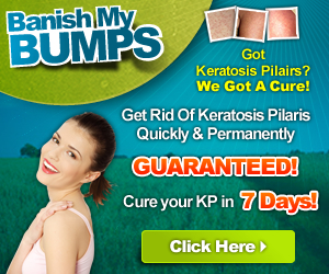 Banish My Bumps